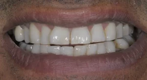 Prancheta-1-copiar-3-1.webp