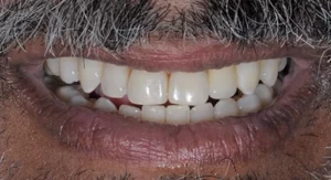 Prancheta-1-copiar-7.webp